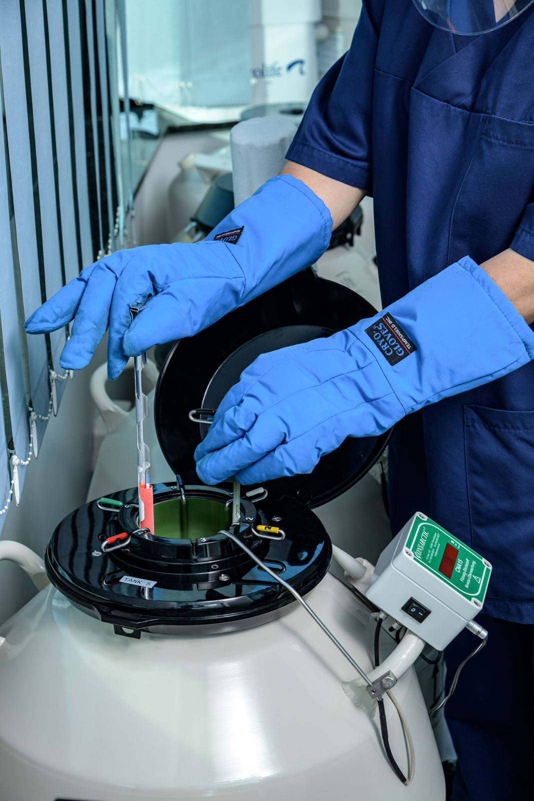 Kryokonservierung im reproduktionsmedizinischen Labor – Arbeit mit Cryo-Schutzhandschuhen am Stickstofftank